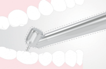 Thumb enc039r1 nufona handpiece catalogue hq 17 %e6%8b%b7%e8%b4%9d